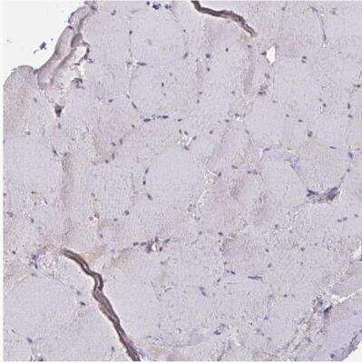 Immunohistochemistry-Paraffin: c-Myc Antibody [NBP2-49201] -  Staining of human skeletal muscle shows weak to moderate positivity in myocytes.