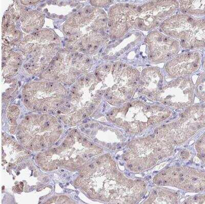 Immunohistochemistry-Paraffin: c-Myc Antibody [NBP2-49201] - Staining of human kidney shows moderate to strong positivity in nucleoli in cells in tubules.