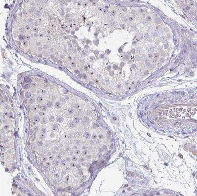 Immunohistochemistry-Paraffin: c-Myc Antibody [NBP2-49201] -  Staining of human testis shows moderate to strong positivity in nucleoli in cells in seminiferous ducts.