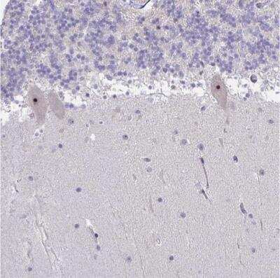 Immunohistochemistry-Paraffin: c-Myc Antibody [NBP2-49201] - Staining of human cerebellum shows moderate to strong positivity in nucleoli in purkinje cells.