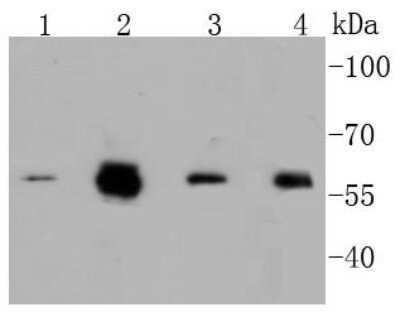 Western Blot: c-Myc [p Ser62] Antibody (ST49-08) [NBP2-67535] - Analysis of Phospho-c-Myc(S62) on different lysates using anti-Phospho-c-Myc(S62) antibody at 1/1,000 dilution. Positive control: Lane 1: A549 Lane 2: HCT116 Lane 3: Hela Lane 4: HepG2