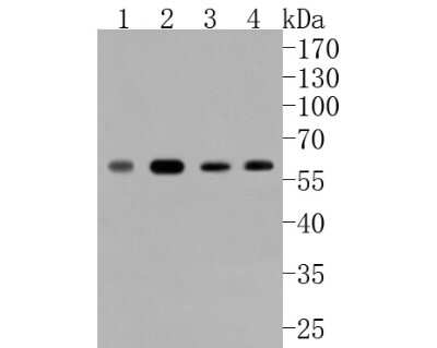 Western Blot: c-Myc [p Ser62] Antibody (ST49-08) [NBP2-67535] - Western blot analysis of c-Myc on different lysates. Proteins were transferred to a PVDF membrane and blocked with 5% BSA in PBS for 1 hour at room temperature. The primary antibody (1/500) was used in 5% BSA at room temperature for 2 hours. Goat Anti-Rab