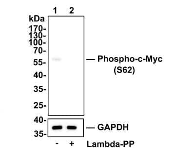 Western Blot: c-Myc [p Ser62] Antibody (ST49-08) [NBP2-67535] - Analysis of c-Myc [p Ser62] on HepG2 cell lysates. Lane 1: HepG2 cells, whole cell lysate, 10ug/lane Lane 2: HepG2 cells treated with 2.8ug/ul lambda-PP for 30 minutes, whole cell lysates, 10ug/lane All lanes : Anti-c-Myc [p Ser62] antibody at 1:500 dilution. Anti-GAPDH antibody at 1:10,000 dilution. Goat Anti-Rabbit IgG H&L (HRP) at 1/200,000 dilution. Predicted band size: 49 kDa Observed band size: 57 kDa Blocking and diluting buffer: 5% BSA. Exposure time: 3 minutes