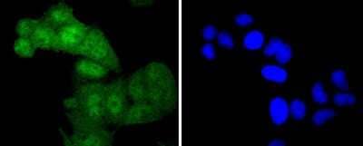 Immunocytochemistry/Immunofluorescence: c-Myc [p Thr58] Antibody (SN60-01) [NBP2-67660] - Staining phospho-c-Myc(T58) in Hela cells (green). The nuclear counter stain is DAPI (blue). Cells were fixed in paraformaldehyde, permeabilised with 0.25% Triton X100/PBS.