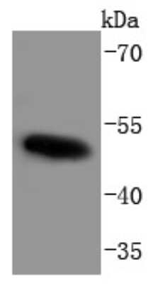 Western Blot: c-Myc [p Thr58, p Ser62] Antibody (SZ02-06) [NBP2-67361] - Analysis of Phospho-c-Myc(T58+S62) on K562 cells lysates using anti-Phospho-c-Myc(T58+S62) antibody at 1/1,000 dilution.