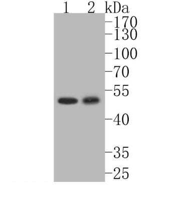 Western Blot: c-Myc [p Thr58, p Ser62] Antibody (SZ02-06) [NBP2-67361] - Analysis of Phospho-c-Myc (T58+S62) on different lysates. Proteins were transferred to a PVDF membrane and blocked with 5% BSA in PBS for 1 hour at room temperature. The primary antibody (1/500) was used in 5% BSA at room temperature for 2 hours. Goat Anti-Rabbit IgG - HRP Secondary Antibody at 1:5,000 dilution was used for 1 hour at room temperature. Positive control:Lane 1: K562 cell lysate Lane 2: SH-SY5Y cell lysate