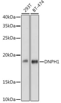 Western Blot: c-Myc-responsive protein Rcl Antibody (7C1Z8) [NBP3-16115] - Western blot analysis of extracts of various cell lines, using c-Myc-responsive protein Rcl antibody (NBP3-16115) at 1:1000 dilution. Secondary antibody: HRP Goat Anti-Rabbit IgG (H+L) at 1:10000 dilution. Lysates/proteins: 25ug per lane. Blocking buffer: 3% nonfat dry milk in TBST. Detection: ECL Basic Kit. Exposure time: 60s.