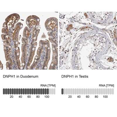 Immunohistochemistry-Paraffin: c-Myc-responsive protein Rcl Antibody [NBP1-85180] - Analysis in human duodenum and testis tissues. Corresponding c-Myc-responsive protein Rcl RNA-seq data are presented for the same tissues.