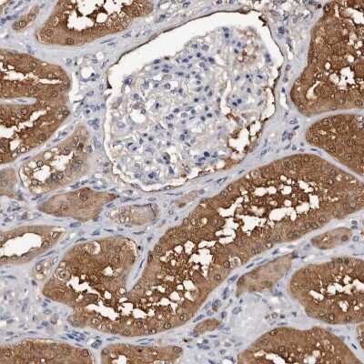 Immunohistochemistry-Paraffin: c-Myc-responsive protein Rcl Antibody [NBP1-85180] - Staining of human kidney shows strong cytoplasmic positivity in cells in tubules.