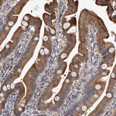 Immunohistochemistry-Paraffin: c-Myc-responsive protein Rcl Antibody [NBP1-85181] - Staining of human duodenum shows high expression.