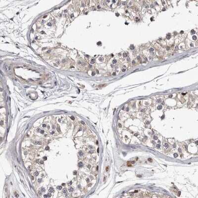 Immunohistochemistry-Paraffin: c-Myc-responsive protein Rcl Antibody [NBP1-85181] - Staining of human testis shows low expression as expected.