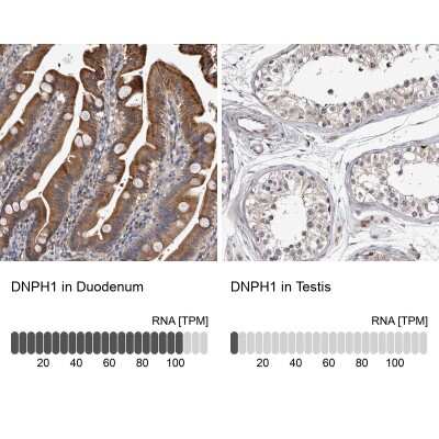 <b>Orthogonal Strategies Validation. </b>Immunohistochemistry-Paraffin: c-Myc-responsive protein Rcl Antibody [NBP1-85181] - Staining in human duodenum and testis tissues using anti-DNPH1 antibody. Corresponding DNPH1 RNA-seq data are presented for the same tissues.