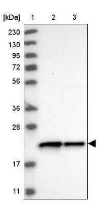 <b>Orthogonal Strategies Validation. </b>Western Blot: c-Myc-responsive protein Rcl Antibody [NBP1-85180] - Lane 1: Marker  [kDa] 230, 130, 95, 72, 56, 36, 28, 17, 11.  Lane 2: Human cell line RT-4.  Lane 3: Human cell line U-251MG sp