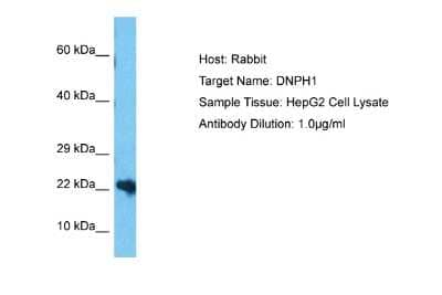 Western Blot: c-Myc-responsive protein Rcl Antibody [NBP2-84699] - Host: Rabbit. Target Name: DNPH1. Sample Type: HepG2 Whole Cell lysates. Antibody Dilution: 1.0ug/ml