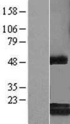 Western Blot: c-Myc-responsive protein Rcl Overexpression Lysate (Adult Normal) [NBL1-08506] Left-Empty vector transfected control cell lysate (HEK293 cell lysate); Right -Over-expression Lysate for c-Myc-responsive protein Rcl.