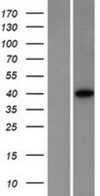 Western Blot: cAMP Protein Kinase Catalytic subunit alpha Overexpression Lysate (Adult Normal) [NBP2-04478] Left-Empty vector transfected control cell lysate (HEK293 cell lysate); Right -Over-expression Lysate for cAMP Protein Kinase Catalytic subunit alpha.