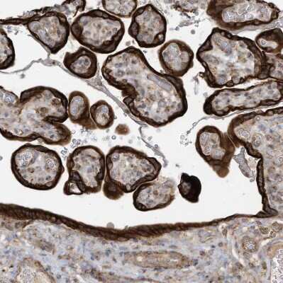Immunohistochemistry-Paraffin: cGAS Antibody [NBP2-55374] - Staining of human placenta shows strong cytoplasmic positivity in trophoblastic cells.