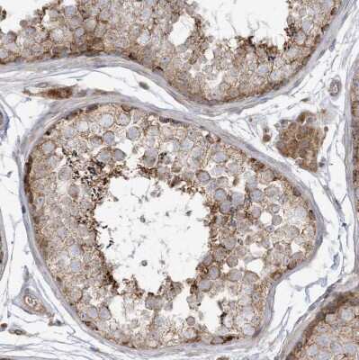 Immunohistochemistry-Paraffin: cGAS Antibody [NBP2-55374] - Staining of human testis shows moderate cytoplasmic positivity in cells in seminiferous ducts.