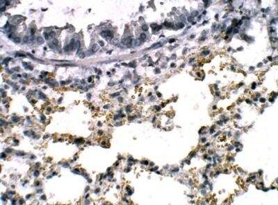 Immunohistochemistry-Paraffin: cGAS Antibody [NBP3-12371] - Mouse lung. 1:100 diluiton in IHC blocking buffer. DAB (brown) staining and Hematoxylin QS (blue) counterstain. 40X magnification. 