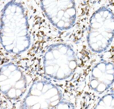 Immunohistochemistry-Paraffin: cGAS Antibody [NBP3-16666] -  Human colon using cGAS Rabbit pAb at dilution of 1:50 (40x lens).Perform high pressure antigen retrieval with 10 mM citrate buffer pH 6.0 before commencing with IHC staining protocol.