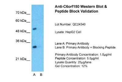 Western Blot: cGAS Antibody [NBP1-70755] - Sample Tissue: HepG2, Lane A: Primary Antibody, Lane B: Primary Antibody + Blocking Peptide, Primary Antibody Concentration: 1ug/ml, Peptide Concentration: 5ug/ml, Lysate Quantity: 25ug/lane/lane, Gel Concentration: 0.12