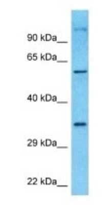 Western Blot: cGAS Antibody [NBP1-70755] - Fetal Liver lysates, Antibody Dilution: 0.2 ug/ml.