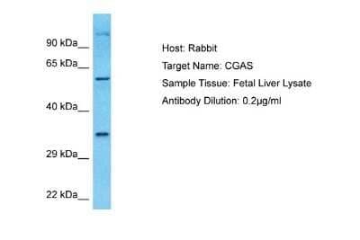 Western Blot: cGAS Antibody [NBP1-70755] - Sample Type: Jurkat Whole Cell lysates Antibody Dilution: 0.2 ug/ml