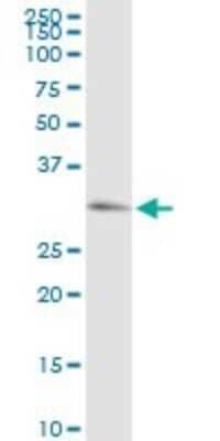 Western Blot: cGK1/PRKG1 Antibody [H00005592-D01P] - Analysis of PRKG1 expression in IMR-32.