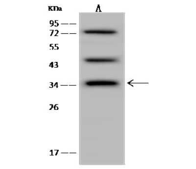 Western Blot: calcium homeostasis modulator 2 Antibody [NBP2-98589] - Anti-calcium homeostasis modulator 2 rabbit polyclonal antibody at 1:500 dilution. Lane A: U-251 MG Whole Cell Lysate Lysates/proteins at 30 ug per lane. Secondary Goat Anti-Rabbit IgG (H+L)/HRP at 1/10000 dilution. Developed using the ECL technique. Performed under reducing conditions. Predicted band size: 36 kDa. Observed band size: 36 kDa