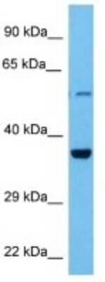 Western Blot: calcium homeostasis modulator 2 Antibody [NBP3-10852] - Western blot analysis of calcium homeostasis modulator 2 in Rat Kidney lysates. Antibody dilution at 1ug/ml