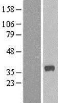 Western Blot: calcium homeostasis modulator 2 Overexpression Lysate (Adult Normal) [NBL1-08648] Left-Empty vector transfected control cell lysate (HEK293 cell lysate); Right -Over-expression Lysate for calcium homeostasis modulator 2.