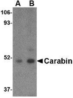 Western Blot: carabin Antibody [NBP1-76806] - Daudi cell lysate with Carabin antibody at (A) 1 and (B) 2 ug/ml.