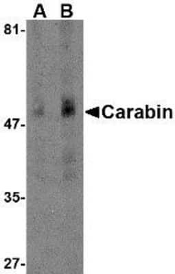 Western Blot: carabin Antibody [NBP1-76807] - Human spleen tissue lysate with Carabin antibody at (A) 1 and (B) 2 ug/ml.