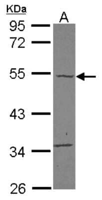 Western Blot: carabin Antibody [NBP2-15695] - Sample (30 ug of whole cell lysate) A: A431 10% SDS PAGE gel, diluted at 1:500.