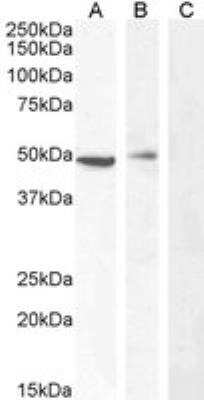 Western Blot: carabin Antibody [NBP2-76349] - Staining of Jurkat with antibody at 0.5 ug/mL (A), PBM with antibody at 0.3 ug/mL (B) and negative control A431 (C) cell lysate (35 ug protein in RIPA buffer). Detected by chemiluminescence.