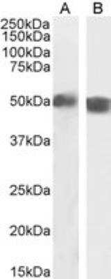 Western Blot: carabin Antibody [NBP2-76349] - Staining of Human Spleen (A) and Mouse Thymus (B) lysate (35 ug protein in RIPA buffer). Antibody at 2 ug/mL. Detected by chemiluminescence.