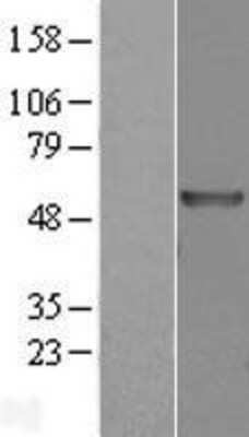 Western Blot: carabin Overexpression Lysate (Adult Normal) [NBL1-16721] Left-Empty vector transfected control cell lysate (HEK293 cell lysate); Right -Over-expression Lysate for carabin.