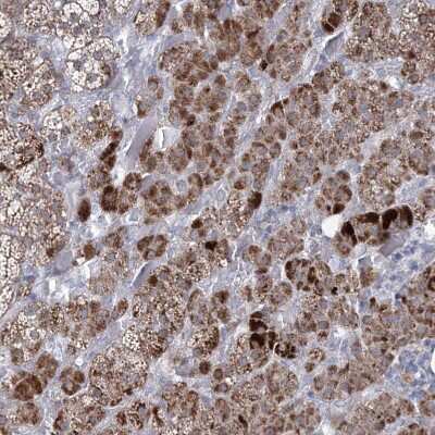 Immunohistochemistry-Paraffin: carboxylesterase 4A Antibody [NBP1-90638] - Staining of human adrenal gland shows moderate cytoplasmic positivity in glandular cells.