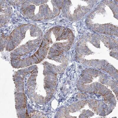 Immunohistochemistry-Paraffin: carboxylesterase 4A Antibody [NBP1-90638] - Staining of human fallopian tube shows moderate cytoplasmic positivity in glandular cells.
