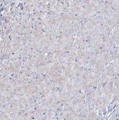 Immunohistochemistry-Paraffin: carboxylesterase 4A Antibody [NBP1-90638] -  Staining of human smooth muscles shows no positivity as expected.