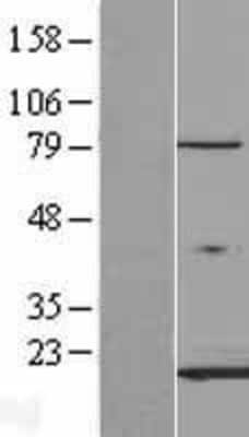 Western Blot: cardiac FABP Overexpression Lysate (Adult Normal) [NBL1-10419] Left-Empty vector transfected control cell lysate (HEK293 cell lysate); Right -Over-expression Lysate for cardiac FABP.