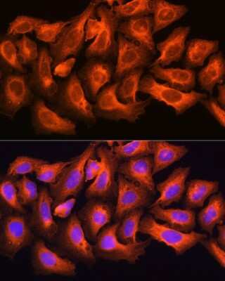 Immunocytochemistry/Immunofluorescence: ch-TOG Antibody [NBP2-92555] - Immunofluorescence analysis of U2OS cells using ch-TOG antibody (NBP2-92555) at dilution of 1:100. Blue: DAPI for nuclear staining.
