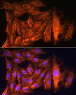 Immunocytochemistry/Immunofluorescence: ch-TOG Antibody [NBP2-92555] - Immunofluorescence analysis of Rat H9C2 cells using ch-TOG antibody (NBP2-92555) at dilution of 1:100. Blue: DAPI for nuclear staining.