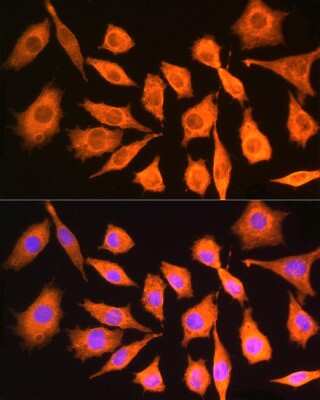 Immunocytochemistry/Immunofluorescence: ch-TOG Antibody [NBP2-92555] - Immunofluorescence analysis of Mouse L929 cells using ch-TOG antibody (NBP2-92555) at dilution of 1:100. Blue: DAPI for nuclear staining.