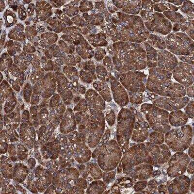 Immunohistochemistry: ch-TOG Antibody [NBP1-85625] - Immunohistochemical staining of human pancreas shows strong cytoplasmic positivity in exocrine glandular cells.