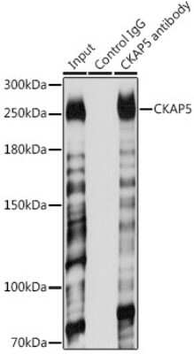 Immunoprecipitation: ch-TOG Antibody [NBP2-92555] - Immunoprecipitation analysis of 200ug extracts of Jurkat cells using 3ug ch-TOG antibody (NBP2-92555). Western blot was performed from the immunoprecipitate using ch-TOG antibody (NBP2-92555) at a dilution of 1:1000.