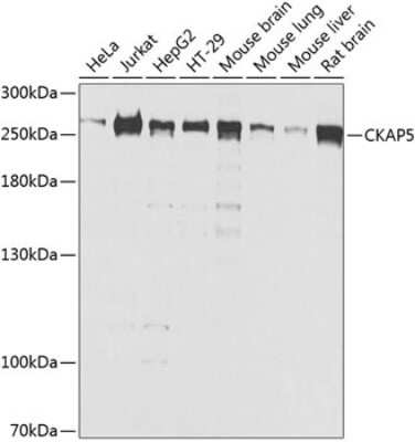 Western Blot: ch-TOG Antibody [NBP2-92555] - Analysis of extracts of various cell lines, using ch-TOG at 1:1000 dilution.Secondary antibody: HRP Goat Anti-Rabbit IgG (H+L) at 1:10000 dilution.Lysates/proteins: 25ug per lane.Blocking buffer: 3% nonfat dry milk in TBST.Detection: ECL Basic Kit .Exposure time: 10s.