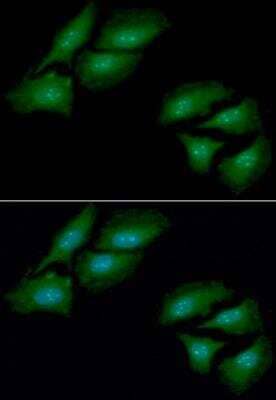 Immunocytochemistry/Immunofluorescence: cleavage stimulation factor Antibody (10E11) [NBP2-42659] - Analysis of CSTF1 in HeLa cells line, stained with DAPI (Blue) for nucleus staining and monoclonal anti-human CSTF1 antibody (1:100) with goat anti-mouse IgG-Alexa fluor 488 conjugate (Green).