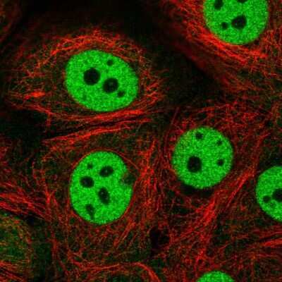 Immunocytochemistry/Immunofluorescence: cleavage stimulation factor Antibody [NBP2-57707] - Staining of human cell line MCF7 shows localization to nucleoplasm.