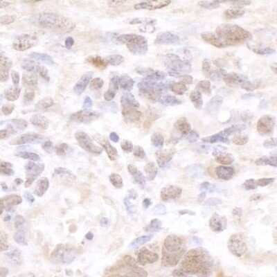 Immunohistochemistry-Paraffin: cleavage stimulation factor Antibody [NB100-60443] - Detection of mouse CSTF50 by immunohistochemistry. Sample: FFPE section of mouse teratoma. Antibody: Affinity purified rabbit anti-CSTF50 (NB100-60443). Detection: DAB